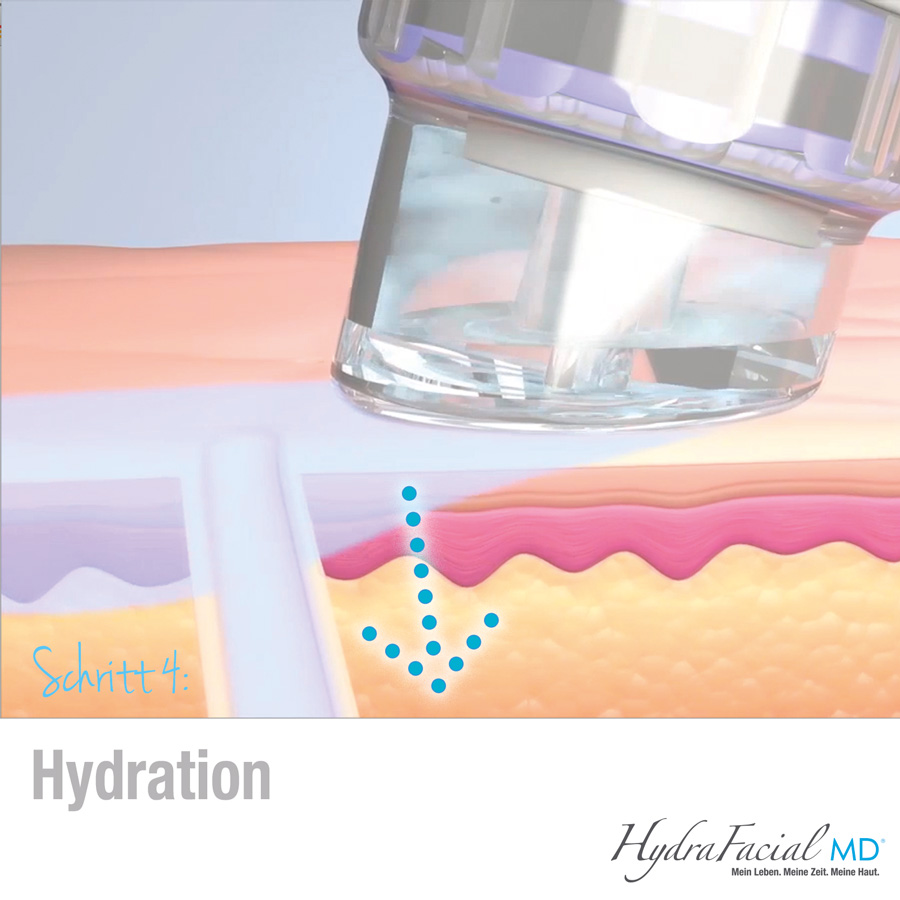 Mit der Hydrafacial Hydratation werden der Haut Seren zugeführt.